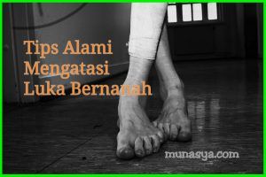 Tips Alami Mengatasi Luka Bernanah