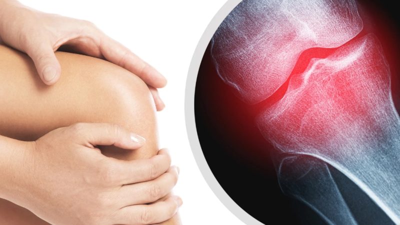 Kenali Waktu yang Tepat Mengatasi Nyeri Sendi